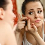 Adult-Acne-Treatments